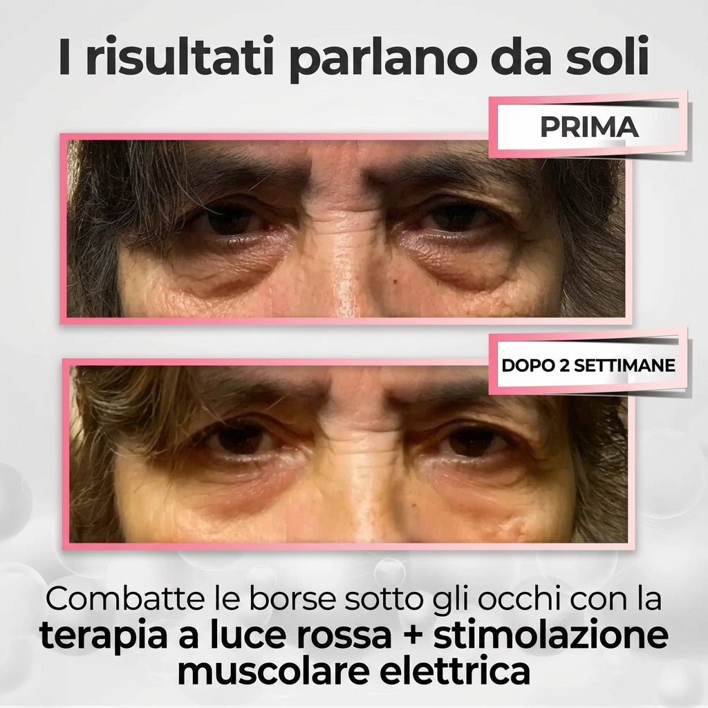 Revita-Lift®️
